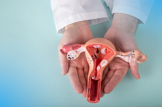 Homeopathy for Gynecological Disorders